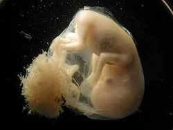 Стволовые клетки без вреда эмбриону