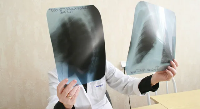 Минздравсоцразвития разработало перечень профессиональных заболеваний